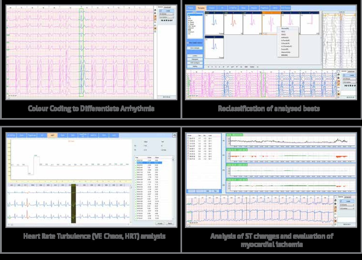 Holter analysis software showing color-coded arrhythmia, heart rate turbulence and ST change analysis