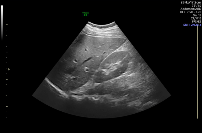 Ultrasound Machine